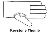 glove-designs-keystone-thum.jpg